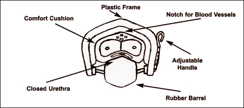 Penile incontinence clamp indications.