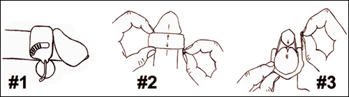 J Clamp instructions for penile compression clamp